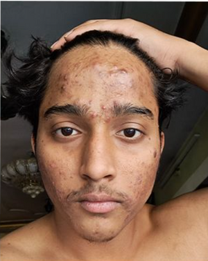 Before - Mohammed Naizal